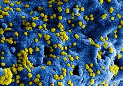 gold spots on a blue background gold spots on a blue background